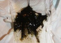 what helps you poop naturally what helps you poop naturally